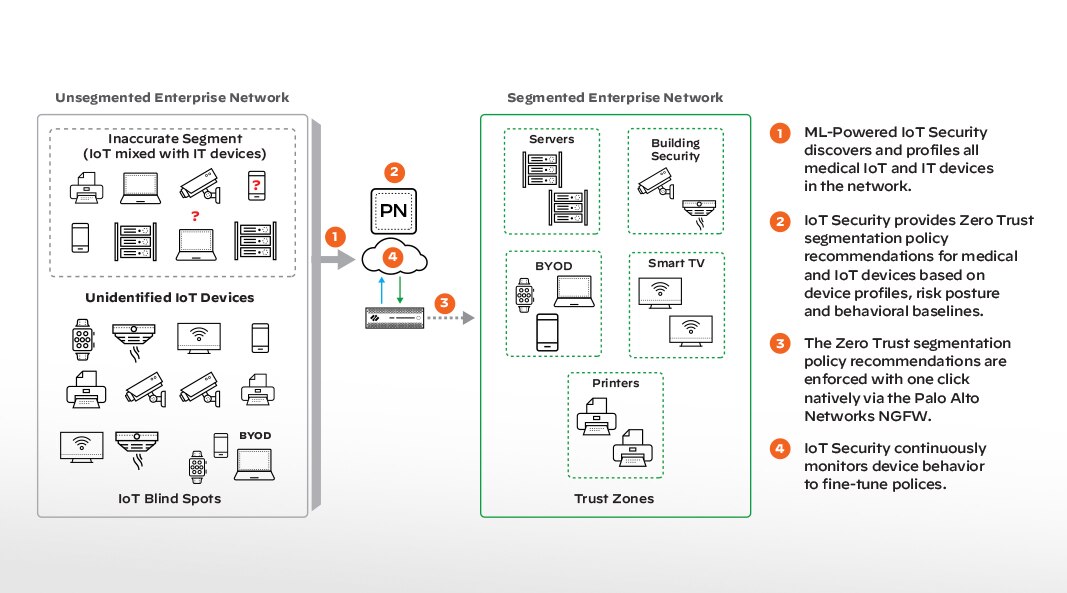 Elimina le zone morte del NAC
